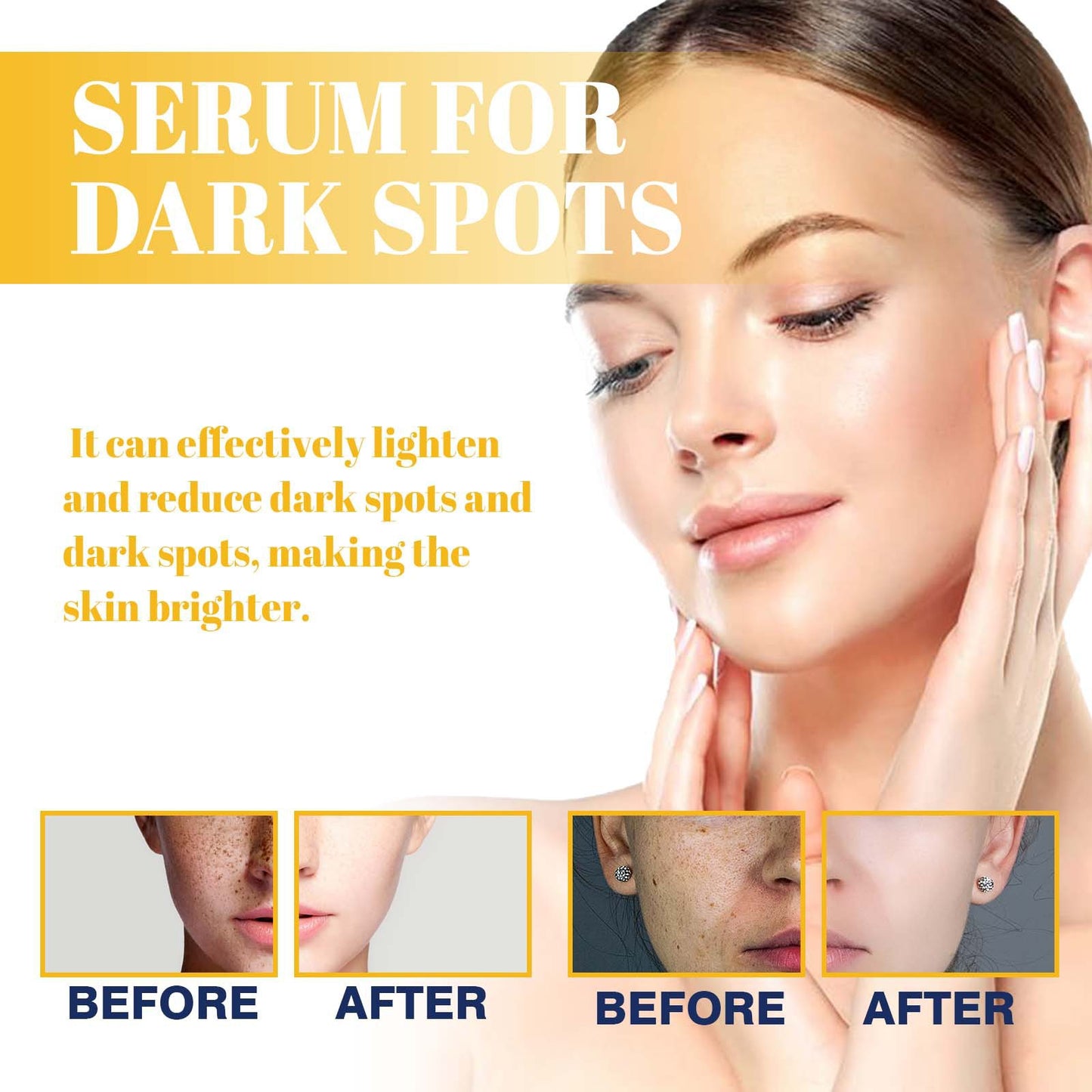 Dark Spot Correcting Serum – Niacinamide Brightening & Hydrating Facial Essence (30ml)
