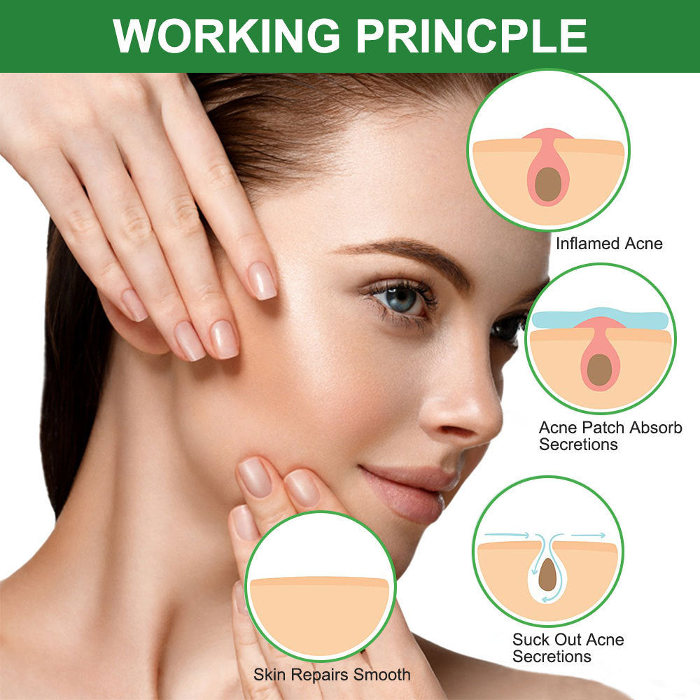 Invisible Acne Patches – Hydrocolloid Pimple Patches for Fast Healing & Spot Protection