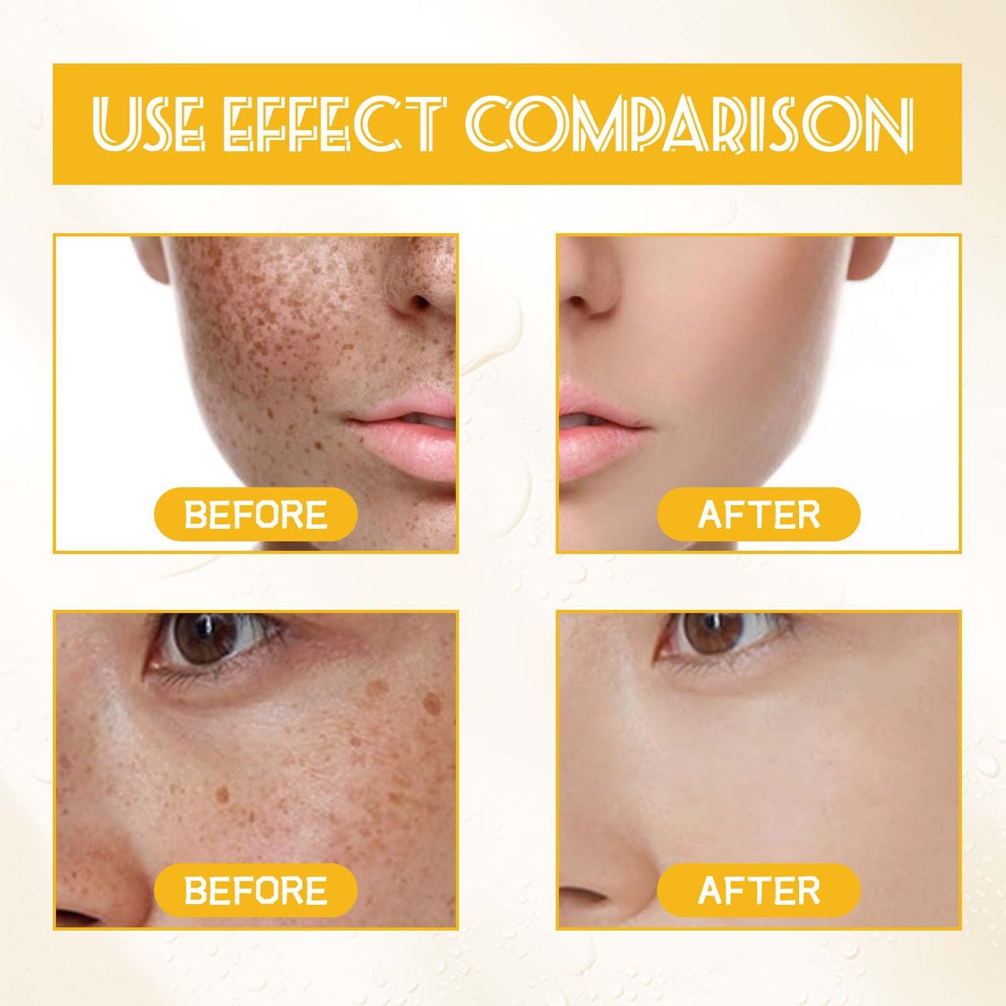 Dark Spot Correcting Serum – Niacinamide Brightening & Hydrating Facial Essence (30ml)